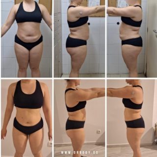 Dr.Body | Pérdida de Grasa y Recomposición Corporal
