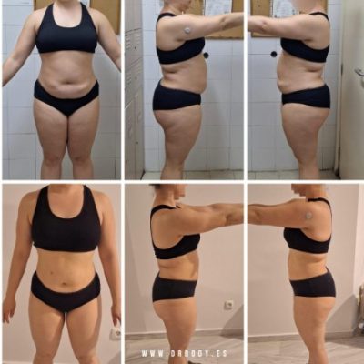 Dr.Body | Pérdida de Grasa y Recomposición Corporal